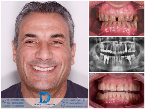 Caso dental 2 - Resultado